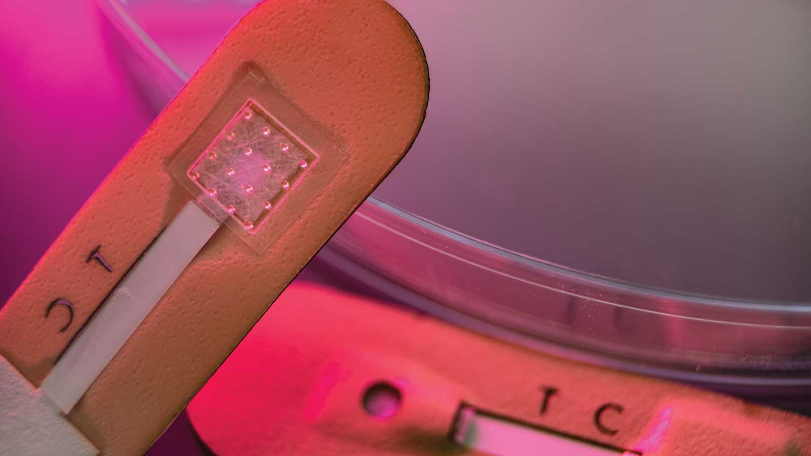 A bandagelike test for malaria features an array of microneedles that collect interstitial fluid from skin and delivers results on a test strip within minutes.