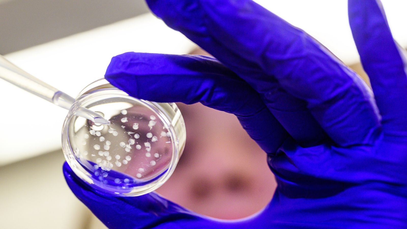 Implanted cell capsules
